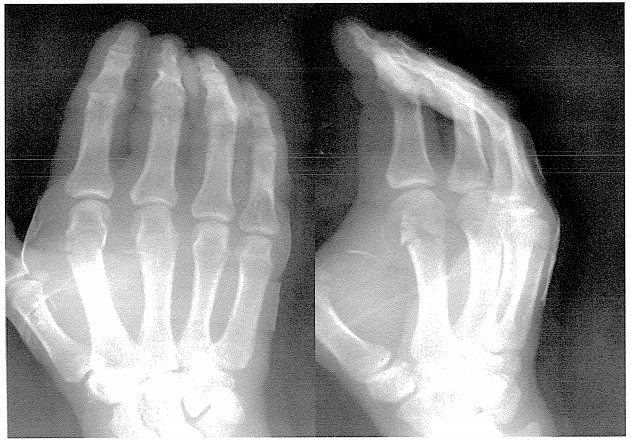 第27回柔道整復師過去問題